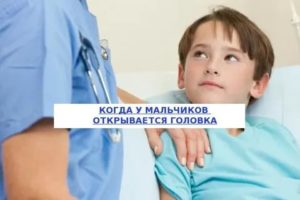 Когда должна открываться головка у мальчика?