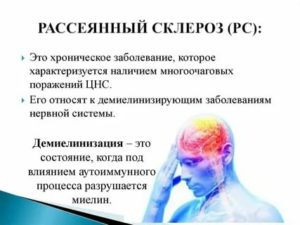 Заразен ли рассеянный склероз?