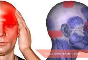 Острая пронизывающая боль в затылочной части головы