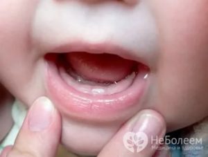 Сиплый голос у ребенка, режутся зубы