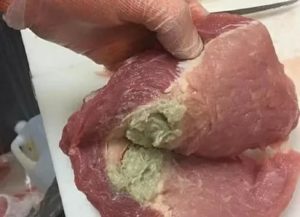 Мог ли кусочек мяса попасть в легкие и до сих пор сейчас быть?