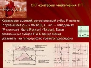 Может ли ЭКГ прояснить ситуацию?