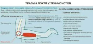 Болят руки в локтевых сгибах