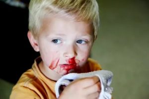 Ребенок упал с дивана кровь из носа