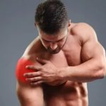 Как лечить растяжение камбаловидной мышцы?