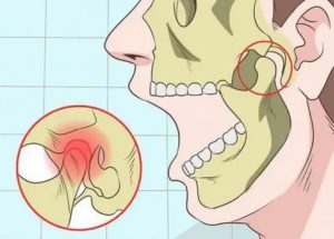 Плохо открывается челюсть