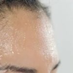 Как замаскировать шрам на лице?