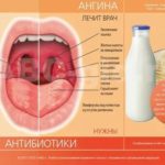 Афлубин и антибиотик