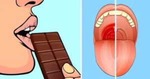 Помогает ли шоколад при болях в горле?