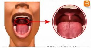 Хронический тонзиллит, зуд в горле