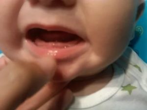 Ребенку 8 месяцев, а зубов нет, почему?