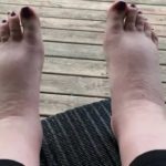 Тянущая боль в ноге после укола