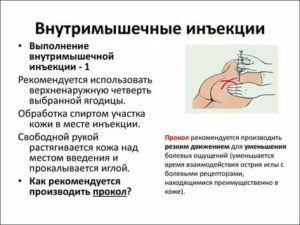 Можно ли поставить внутривенно внутримышечный укол?