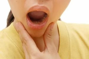 Ожог слизистой рта от хлоргексидина